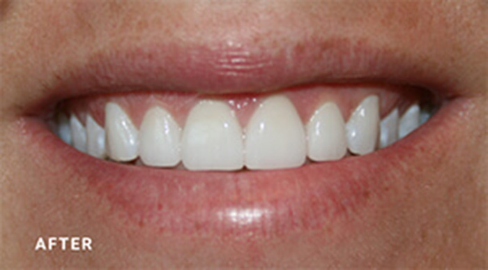 Cosmetic Dentist In Jacksonville