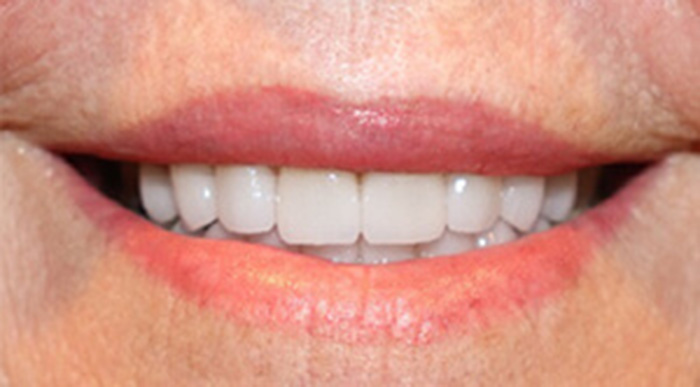 Cosmetic Dentists In Jacksonville
