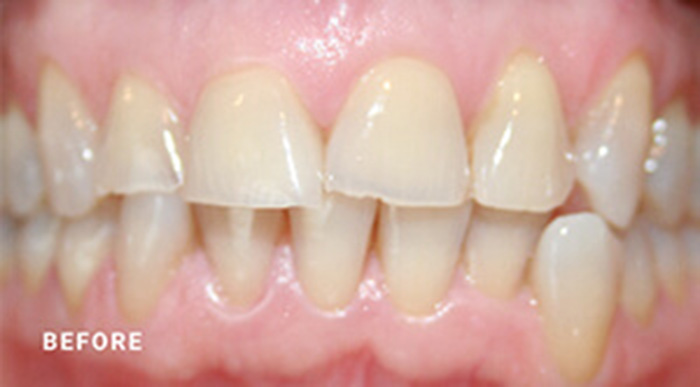 Jacksonville Cosmetic Dental Crown Dentist