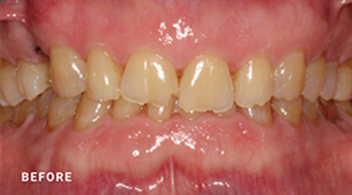 Jacksonville Dental Implant Dentists