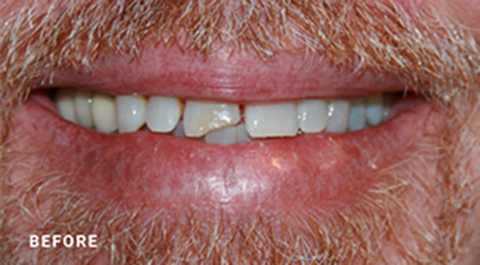 Jacksonville Teeth Whitening Dentists