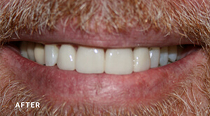 Teeth Whitening Dentists Near Me
