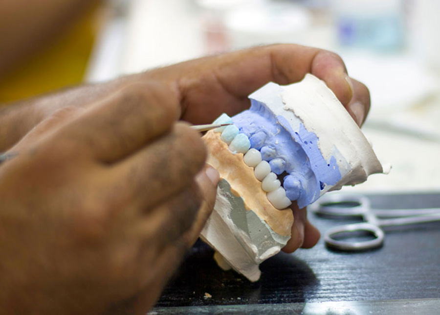 All On X Dental Implants Jacksonville Florida Dentist