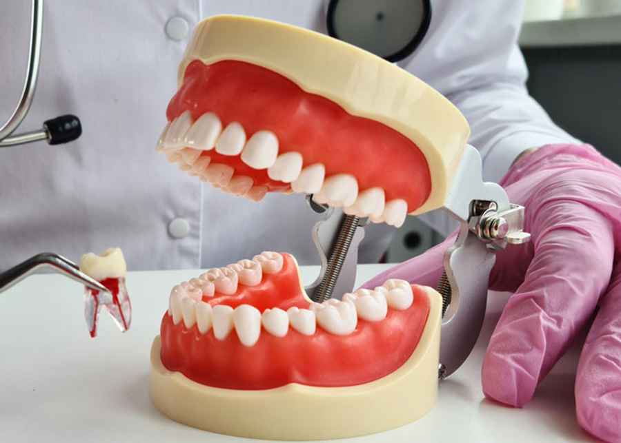 Dental Implants After Tooth Extraction Dentist Jacksonville
