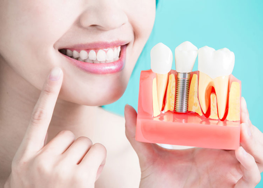 Dental Implants Jacksonville Florida Dentist