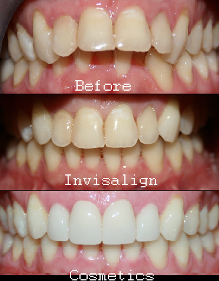 Smile Gallery Cosmetic Dentist in Jacksonville, FL West Dentistry