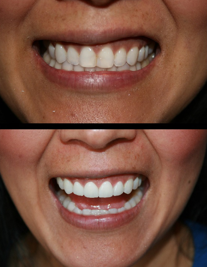 Smile Gallery Cosmetic Dentist in Jacksonville, FL West Dentistry