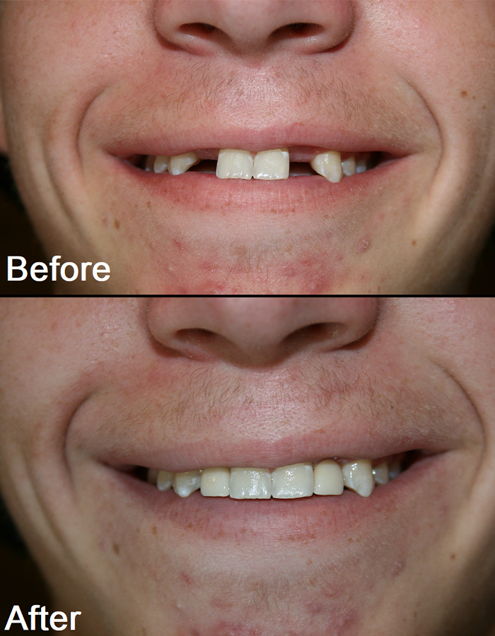 Smile Gallery Cosmetic Dentist in Jacksonville, FL West Dentistry