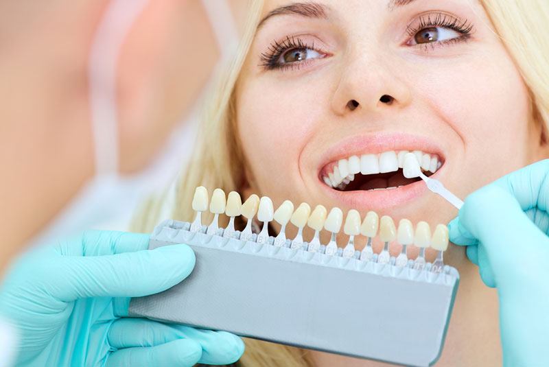 Dental Veneers Patient